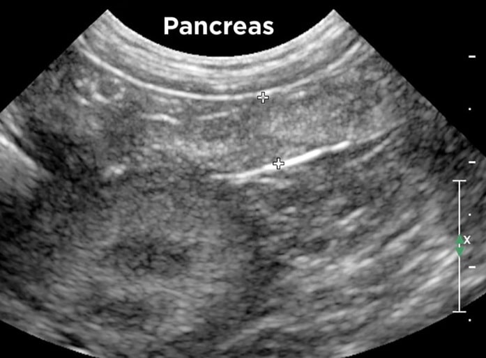 Canine Pancreatitis: Causes, Symptoms, Diagnosis, Treatment, and Long-Term Care - All Creatures Veterinary Center How Veterinarians Diagnose Pancreatitis in Canines?